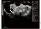 Mesin Ultrasound Portabel untuk Kehamilan Ultrasound Scanner Portabel Berat Hanya 2.2kgs