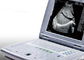 Mesin Ultrasound Portabel untuk Kehamilan Ultrasound Scanner Portabel Berat Hanya 2.2kgs