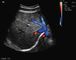 Scanner Ultrasonografi Kehamilan Portabel dengan Transduser Transvaginal Pernapasan Perut