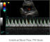 Perangkat Diagnostik Ultrasonik Ipad Scanner Ultrasound Portabel dengan Penyimpanan Gambar 500G