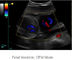 Peralatan Pindai Ultrasound Pemindai Ultrasound Portabel dengan Frekuensi Probe 2. 0MHz ～ 10.  0MHz
