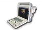 Peralatan Ultrasonografi 4d Scanner Ultrasound Portabel Dengan Probe Bertahap Bertahap dari Frekuensi Pusat 3 MHz