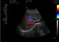 Mesin Medis Ultrasound Scanner Ultrasound Portabel Peralatan Ultrasonografi 4d