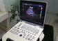 Mesin Usg 4d Scanner Ultrasound Portabel Dengan Kapasitas 120G 4800 Frame Cine Loop