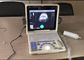 Layar LED 12 Inch Portable Digital Ultrasound Scanner dengan Semua Jenis Probe