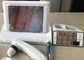 Digital Dermatoscope Video Genggam dengan Layar 8 Inch Menampilkan 1,4,9 Gambar