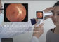 Telemedicine Dalam Ophthalmology Kamera Fundus Digital Sudut Pandang 45 Derajat Perangkat Lunak Wifi Opsional Untuk Laporan