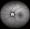 Confocal Retina Opthalmoscope Digital Fundus Camera Dengan FOV 15 °, 30 °, 60 ° Ukuran Gambar 1024 * 1024