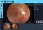 Perangkat Ophthalmoscope Video 1920 X 1080 Piksel 3,5 &quot;