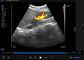 Probe Ultrasound Nirkabel Perangkat Ultrasound Genggam Dengan B, B / M, Doppler Warna, PW, Mode Doppler Daya 192 Elemen