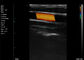 Echo Handheld Color Doppler Linear Scans Carotid Artery 7.5-10MHz Frekuensi