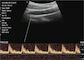 Perangkat Ultrasound Doppler Pemindai Ultrasound Warna Dengan 128 Elemen 13 Aplikasi B BM Warna PDI Mode PW