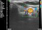 Beranda Doppler Ultrasound Portable Diagnostik Genggam Doppler Ultrasound Obstetric Gynecology Pediatrics Application