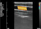 Mesin Ultrasound Berwarna Home Ultrasound Scanner Portable Ultrasound Untuk Kehamilan 8 TGC 3,5 ~ 10 MHz