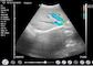 Probe Doppler 10mhz Nirkabel Ultrasound Genggam