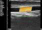Kehamilan Wifi Color Doppler Ultrasound Scanner Dengan Pengukuran Ob / Gyn