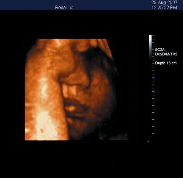 Mesin Ultrasound 3D Portabel Doppler Warna Ultrasound Scanner dengan Layar LED 15 Inch