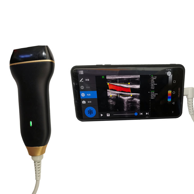 Mesin Pencitraan USG Rumah Color Doppler Ultrasound Scanner dengan Koneksi USB