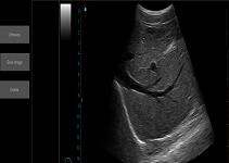 Peralatan Pemindaian Ultrasound Scanner Ultrasound Portabel Mesin Ultrasound Palm Ipad