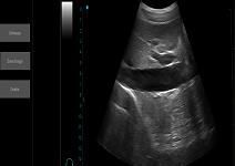 Peralatan Pemindaian Ultrasound Scanner Ultrasound Portabel Mesin Ultrasound Palm Ipad