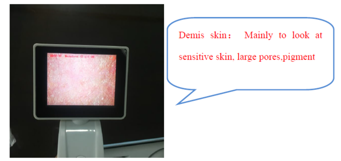 CE BS5SH Digital Skin Analyzer Digital Skin Moisture Meter Untuk Dokter