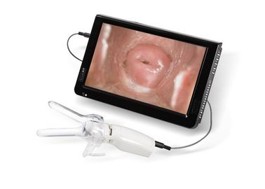 Mini Colposcope untuk Pemeriksaan Cervical Vaginal Camera Terhubung ke TV atau PC