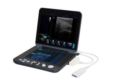 128 Gambar Permanen Storage Portable Digital Ultrasound Scanner dengan Layar LED 12 Inch
