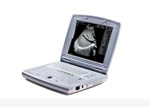 Mesin Ultrasound Bayi Portable Scanner Ultrasound Portabel untuk Pediatri