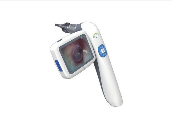 USB Otoscope Camera Video Otoscope Medical Endoscope Sistem Kamera Digital Dengan Penyimpanan Internal 32G