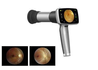 Video Ophthalmoscope 45 ° Kamera Fundus Genggam