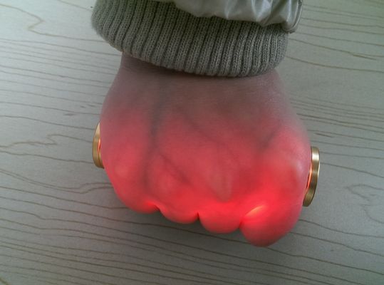 Proyektor Vaskular Vena Venipuncture Vein Inframerah Vein Locator Golden Aluminium