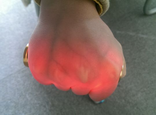 Proyektor Vaskular Vena Venipuncture Vein Inframerah Vein Locator Golden Aluminium