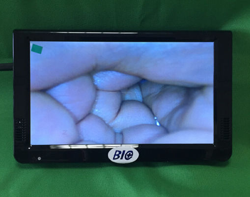 Colposcope Elektronik Digital Portable