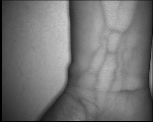 Resolusi Tinggi 800X480 Tabel Jenis Perangkat Vein Locator Dengan Layar 3.5Inch Untuk Kaki Lengan Tangan