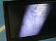 Resolusi Tinggi Vascular Gambar Infrared Vein Locator Device Untuk Pasien obesitas