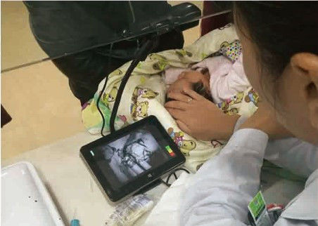 Portable Vein Finder Inframerah Ekonomis Mendeteksi Sekitar 10mm Kedalaman Troli Vena Tersedia