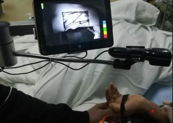 Portable Vein Finder Inframerah Ekonomis Mendeteksi Sekitar 10mm Kedalaman Troli Vena Tersedia