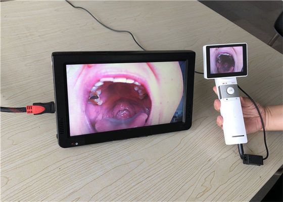 1920x1080 Digital Video Dermatoscope