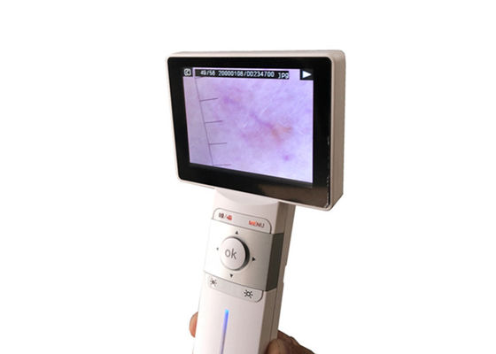 Kulit Telinga Profesional Tenggorokan Kamera Digital Video Otoscope Dengan 1920 x 1080 Pixel