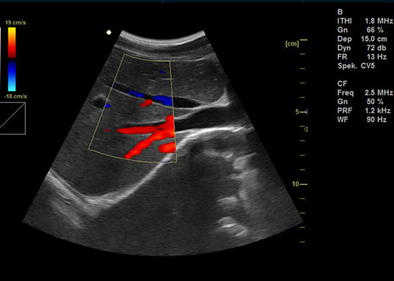 15 inch Full Digital Portable Ultrasound Scanner Peralatan Medis Ultrasonik Diagnostik