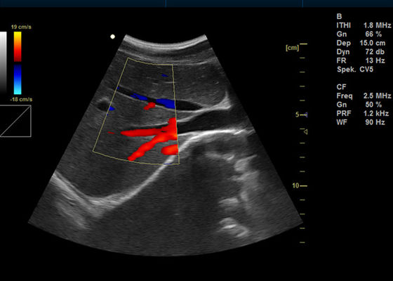 15 inch Full Digital Portable Ultrasound Scanner Peralatan Medis Ultrasonik Diagnostik