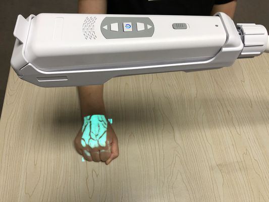 Perangkat Vena Locator Resolusi Gambar Tinggi Desktop Vein Finder Dengan Cahaya Inframerah