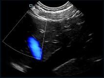Pemindai Ultrasound Genggam Saku Mini