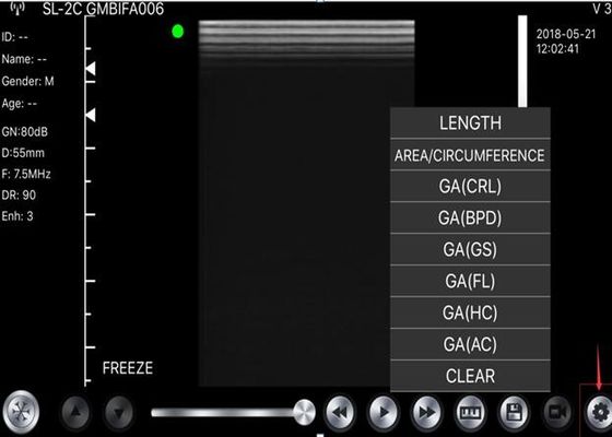 5G Handheld Ultrasound Scanner Convex: 3,5 ~ 5MHz, Linear: 7,5 ~ 10MHz, Jantung: 2,5 ~ 5MHz