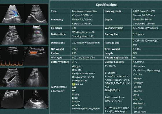 5G Handheld Ultrasound Scanner Convex: 3,5 ~ 5MHz, Linear: 7,5 ~ 10MHz, Jantung: 2,5 ~ 5MHz