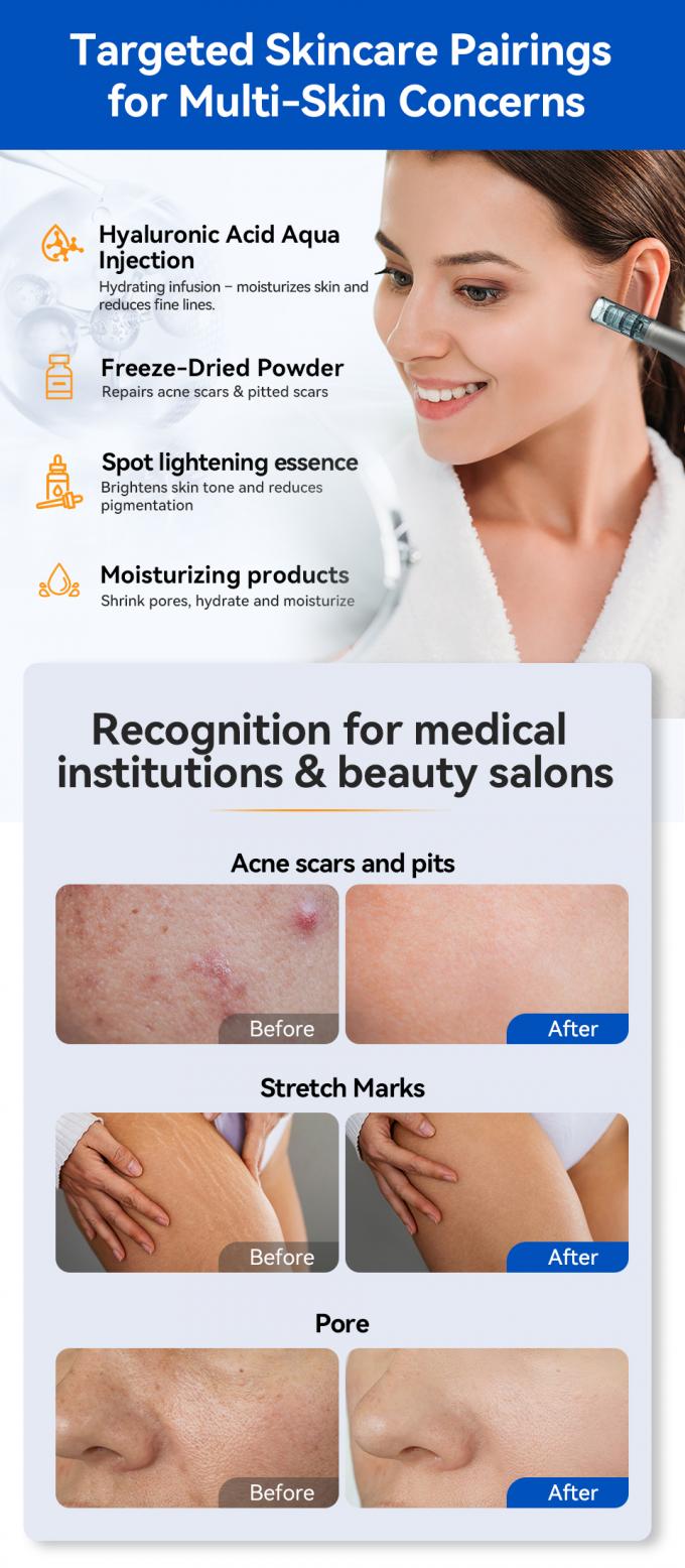 Merek Asli Hydra Pen H5 MicroNeedling Derma Pen dengan EMS Output Serum Adjustable MTS Kurangi Luka Garis halus Kerutan 6