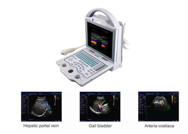 B Ultrasound Scanner Mesin Ultrasound Portable Doppler dengan Berat Hanya 4,5Kgs