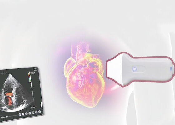 PDI WiFi Wireless Portable Ultrasound Scanner 128 Elemen